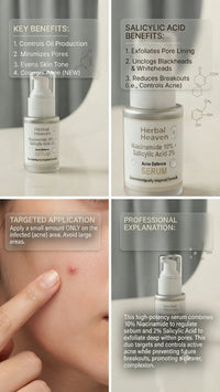 Herbal Heaven Niacinamide 10% + Salicylic Acid 2% Acne Defence Serum
